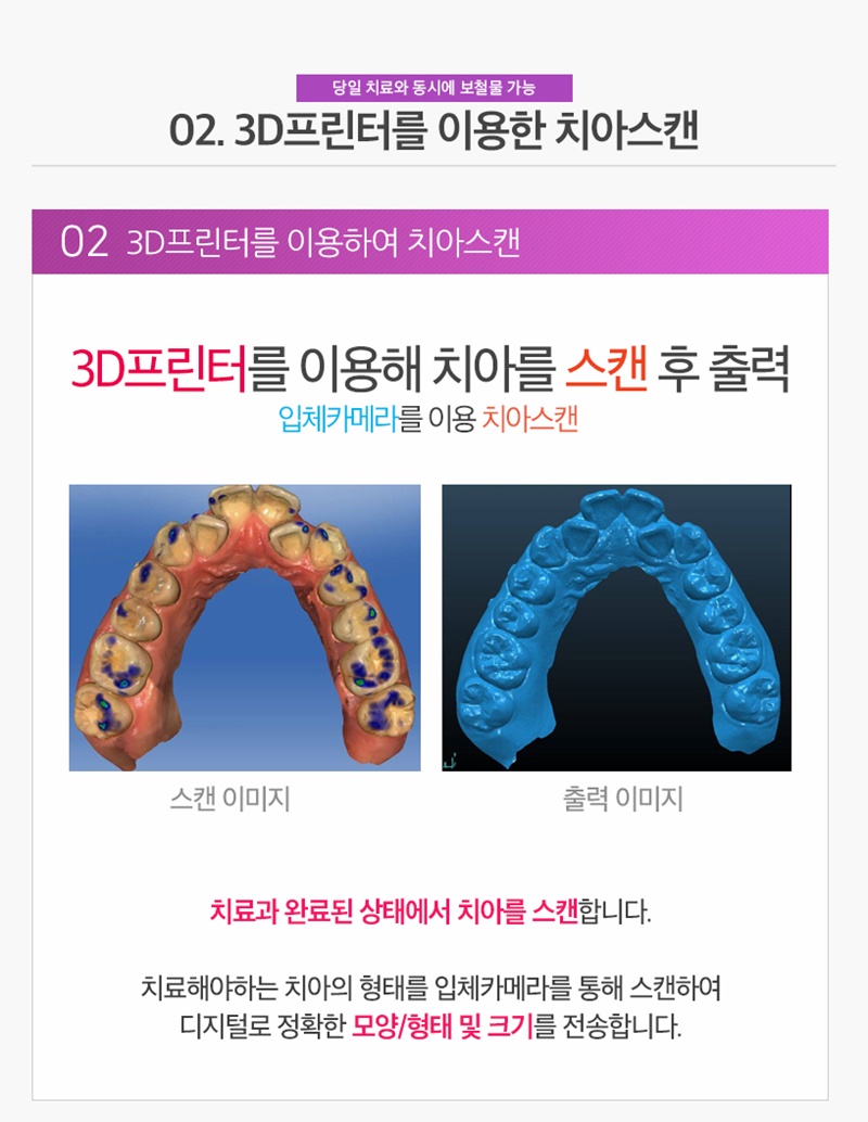 수면마취치과/원데이치과 - 원데이치료과정 : 02. 치아스캔