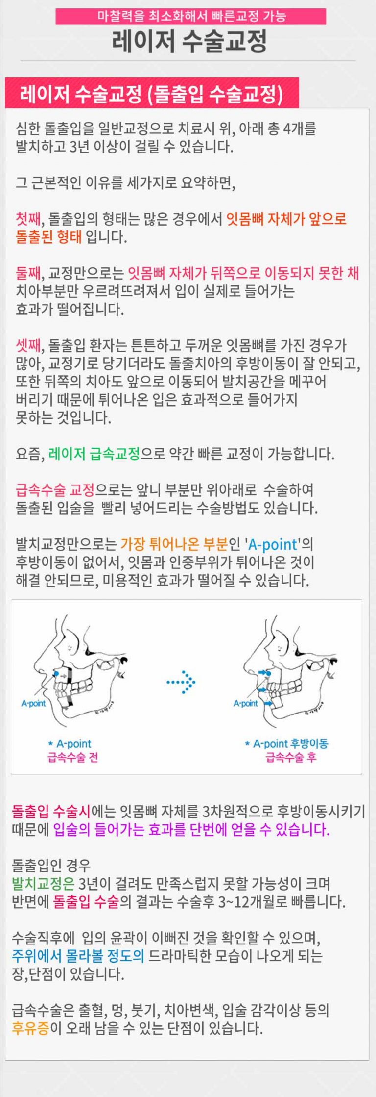 급속교정- 레이저 수술교정 -분당 서현역치과 연세화이트산타치과