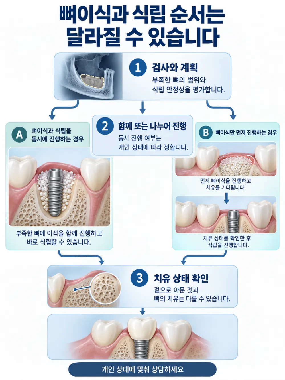 서현역뼈이식임플란트 치료 과정: 검사와 계획, 함께 또는 나누어 진행, 치유 상태 확인