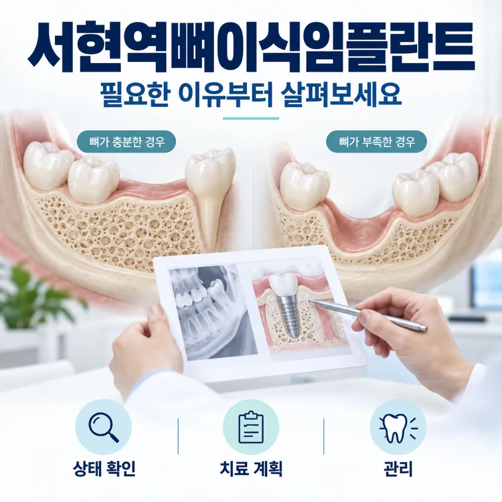 서현역뼈이식임플란트 필요한 이유부터 살펴보세요