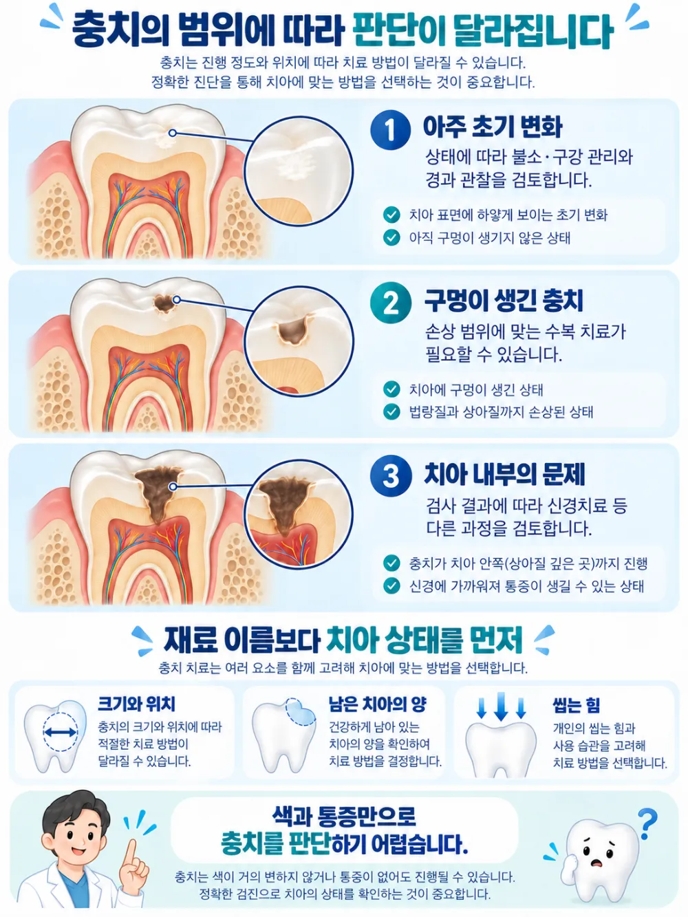 충치의 손상 범위별 관리·수복·내부 평가를 검토하는 기준