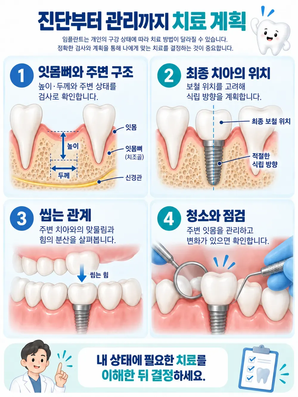 임플란트 치료 계획의 잇몸뼈 평가, 보철 위치, 씹는 관계와 청소·점검