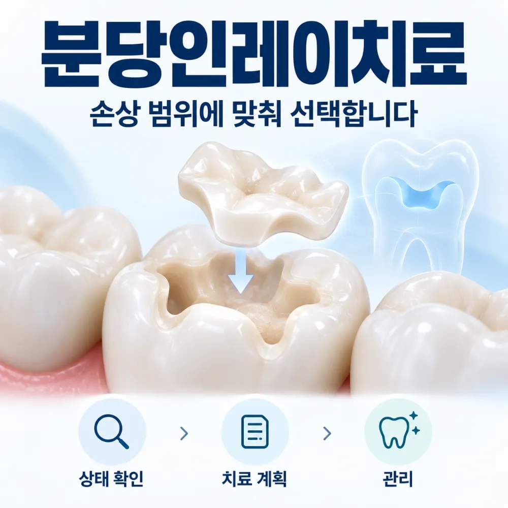 분당인레이치료 손상 범위에 맞춰 선택합니다
